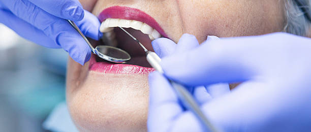 Best Emergency Tooth Extraction in Plainview, TX